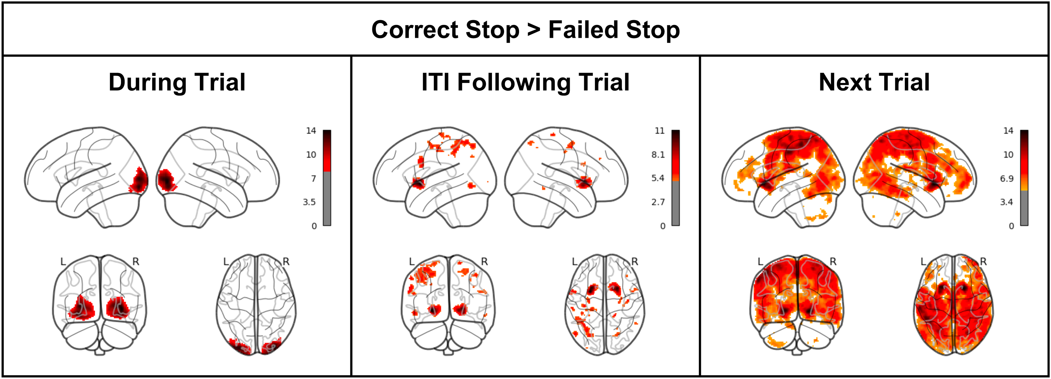 Striatal response to negative feedback in a stop signal task operates ...